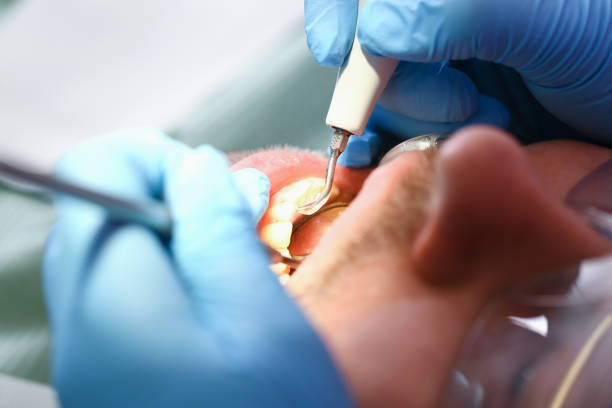 Best Walk-In Emergency Dentist in Larksville, PA