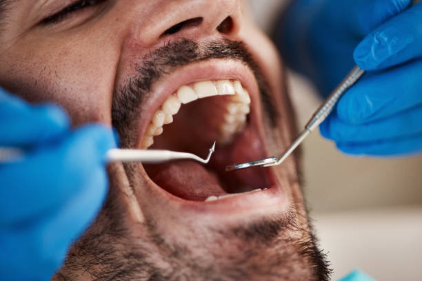 Best Emergency Tooth Extraction in Larksville, PA